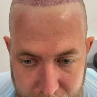 Spencer Before