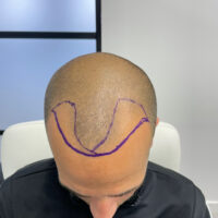 Barry Before
