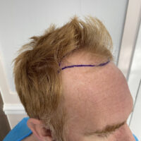Andy Before