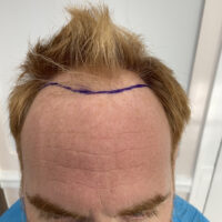 Andy Before