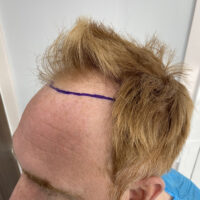 Andy Before