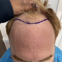 Andy Before