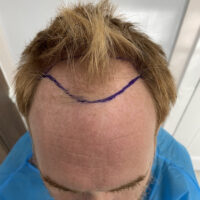 Andy Before