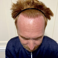 Andy After Result