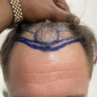 John Before