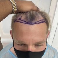 Rene Before