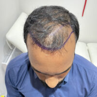 Sri Before