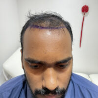 Sri Before