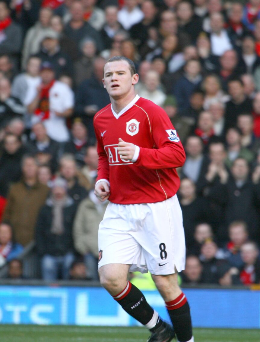 The professional footballer, Wayne Rooney, has had multiple hair transplants.