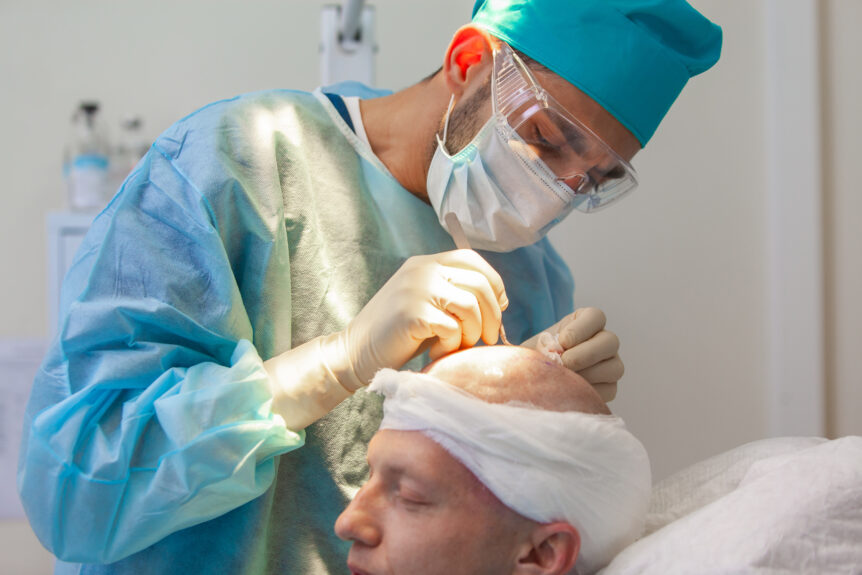 Baldness treatment with hair transplant surgeons in the operating room.