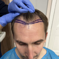 Andrew Before