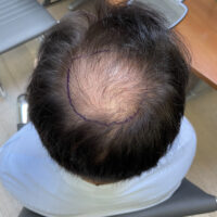Domenico Before