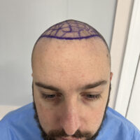 Craig Before