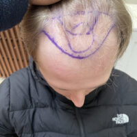 George Before