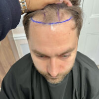 Matt Airey Before