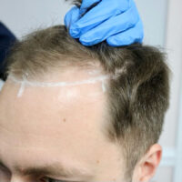 Matt Airey Before