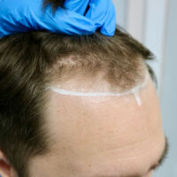 Matt Airey Before
