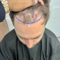 Matt Airey Before