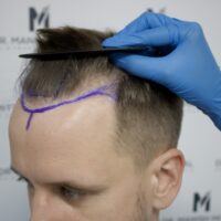 Sam Lemington Before