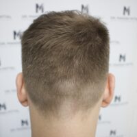 Sam Lemington Before