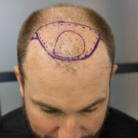 Andrew Little Before