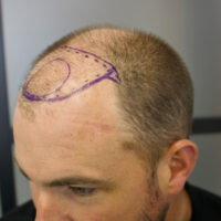 Andrew Little Before