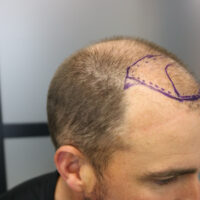 Andrew Little Before