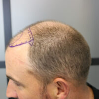 Andrew Little Before