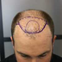 Andrew Little Before
