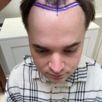 Ben Before