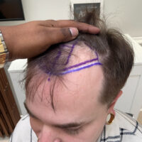 Ben Before