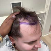 Ben Before