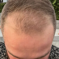 Dom White Before