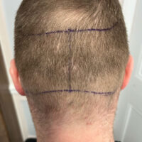 Dom White Before