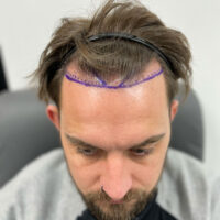 Steve Before