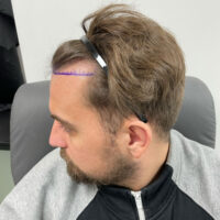 Steve Before