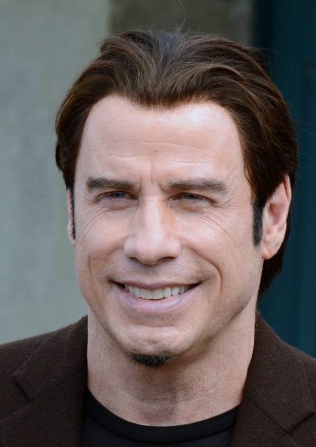 John Travolta’s Hair Transplant from years ago