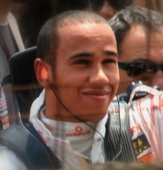 Lewis Hamilton Hair Transplant