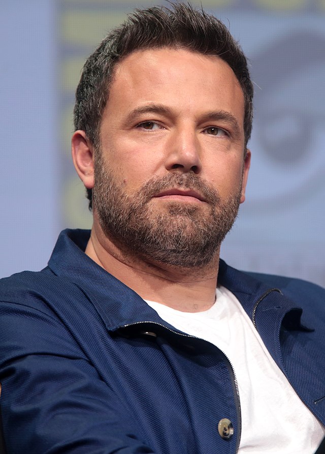 Ben Affleck hair transplant