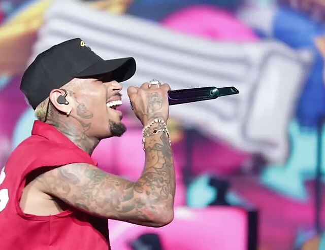 Chris Brown Hair Transplant