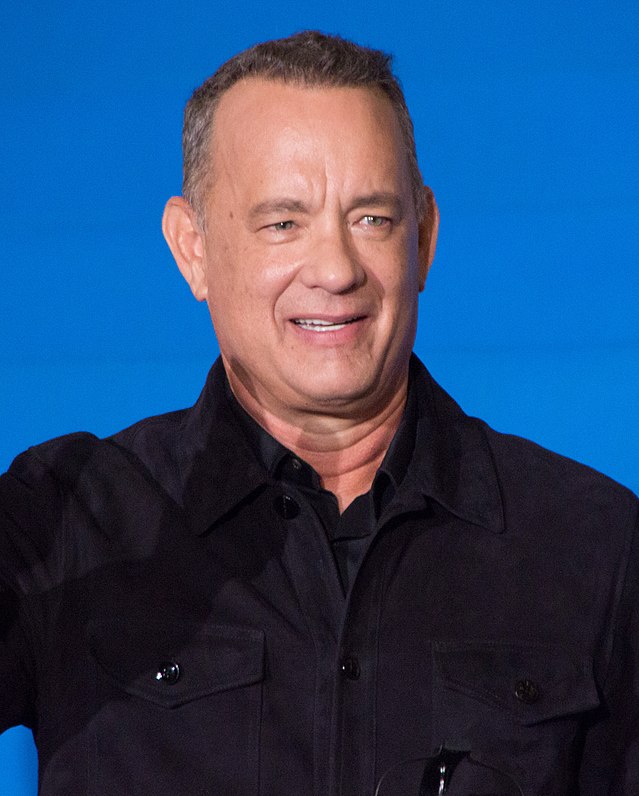 Did Tom Hanks have a hair transplant?