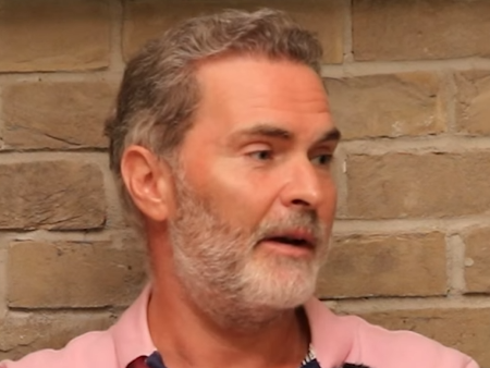 Patient discusses Canadian experience of a hair transplant
