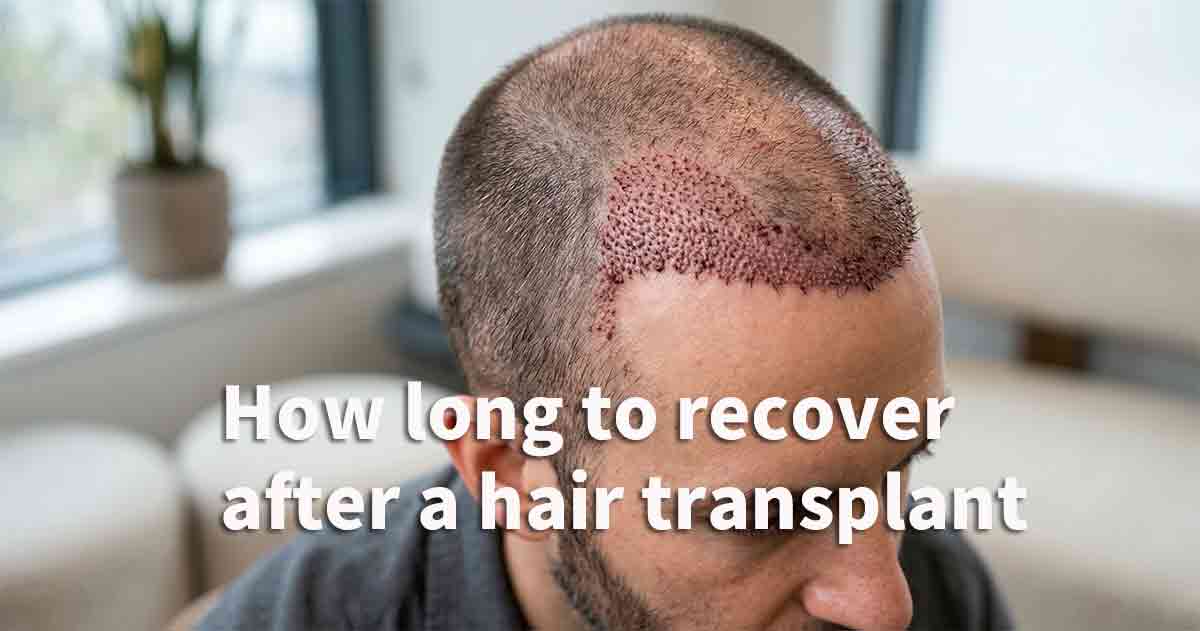 how long does it take to recover from a hair transplant