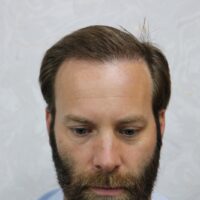 James Dayton After Result
