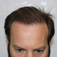 James Dayton After Result