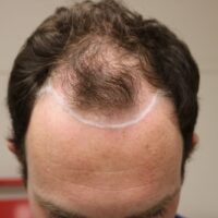 Phillip M Before