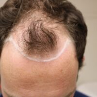 Phillip M Before
