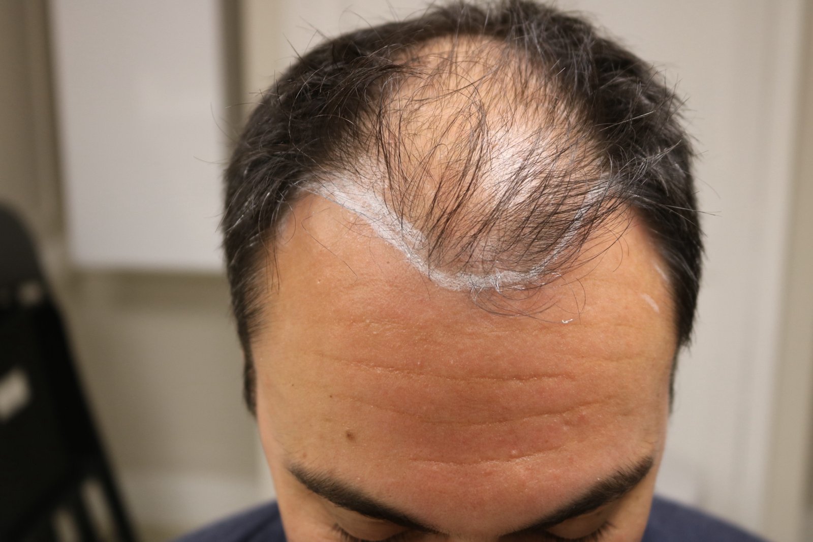 Chris V — before