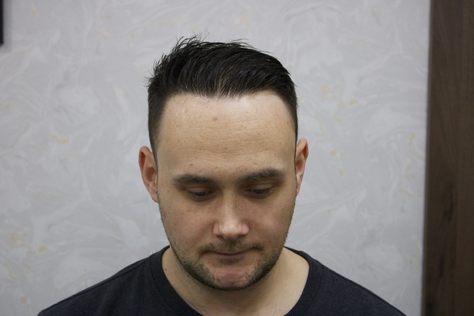 Matt — before