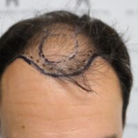 Chris V Before